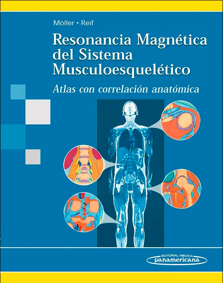 El estudio de los cortes anatómicos normales del sistema musculoesquelético constituye la base indispensable para el diagnóstico de las distintas ...